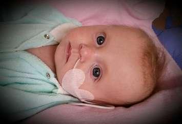 Avery Mailloux, eight months, suffers from pulmonary arterial hypertension.  (courtesy of Facebook All About Avery)