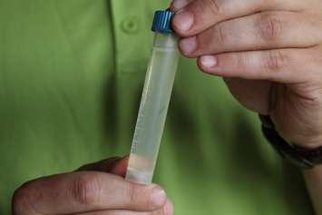 GDG Environment Project Supervisor holds a sample of mosquito larvae from Ojibway Park. (Photo by Mike Vlasveld)