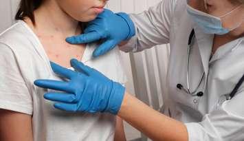 Doctor treating child who has measles (Image by Marina Demidiuk / iStock / Getty Images Plus via Getty Images)